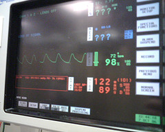 heart monitor